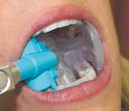ezdam in mouth.jpg