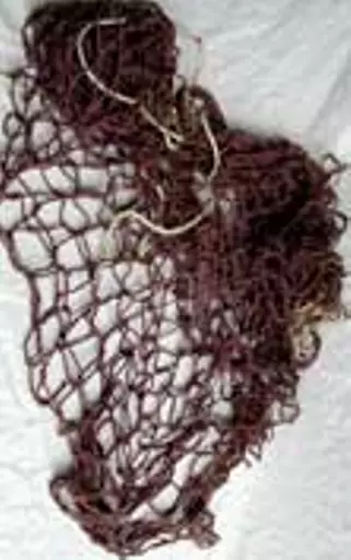 https://starbek-static.myshopblocks.com/images/tmp/se_207_mednet1.5.jpg