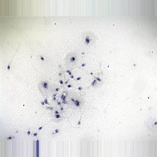 Philip Harris Prepared Microscope Slide - Human Spermatozoa Smear