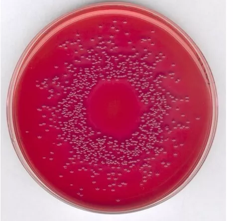 GranuCult® prime MacConkey (MAC) Agar