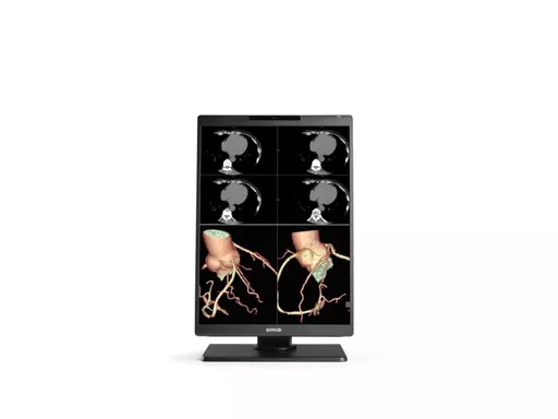 MDNC-x521-front-no-cover-ColorCT-onwhite_preview-jpg.png