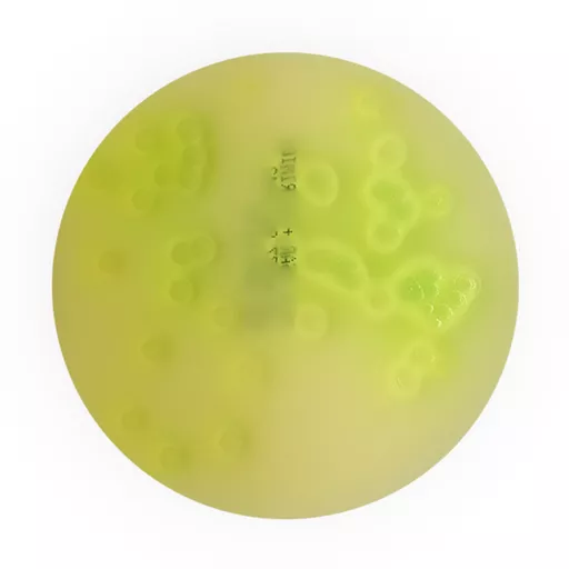 Milk Agar + Cetrimide