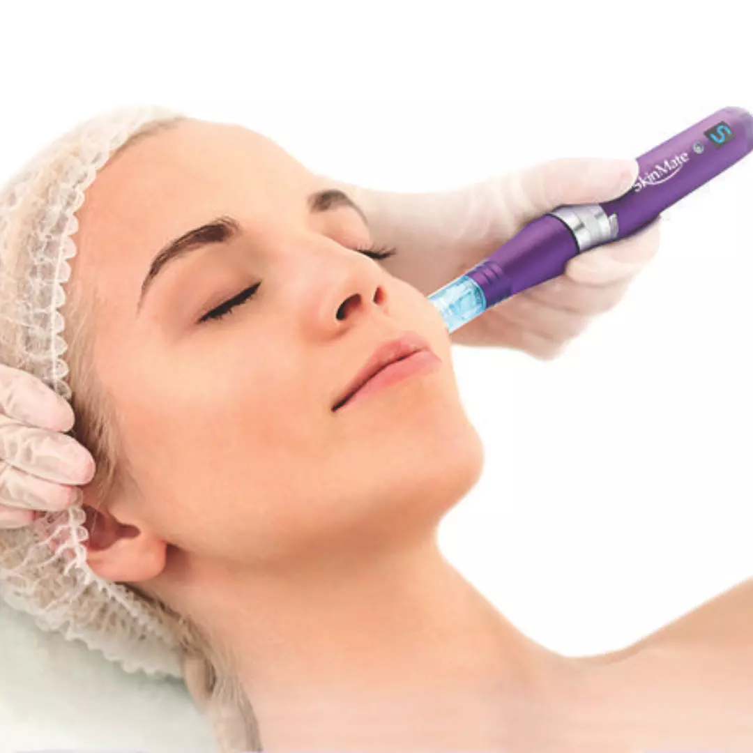 Why You Should Introduce Microneedling to Your Salon in 2025