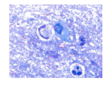Methylene blue (Loeffler) counterstain, for bacteriology