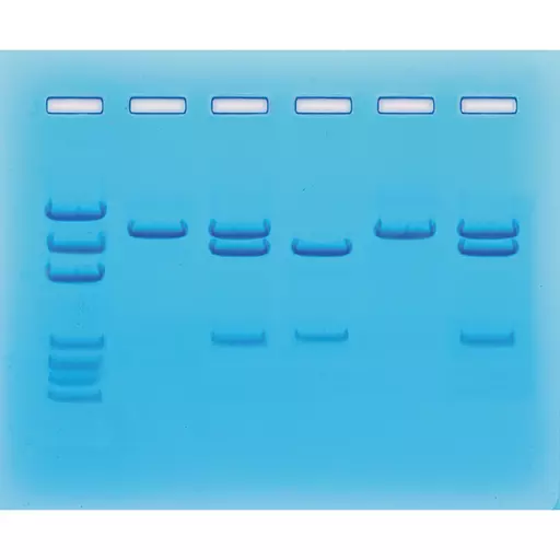 Nucleic Acid Testing for COVID-19