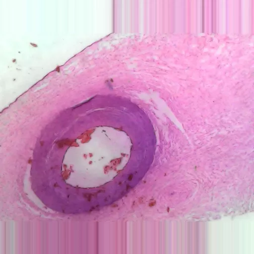 MICROSCOPE SLIDE - Artery and vein slide