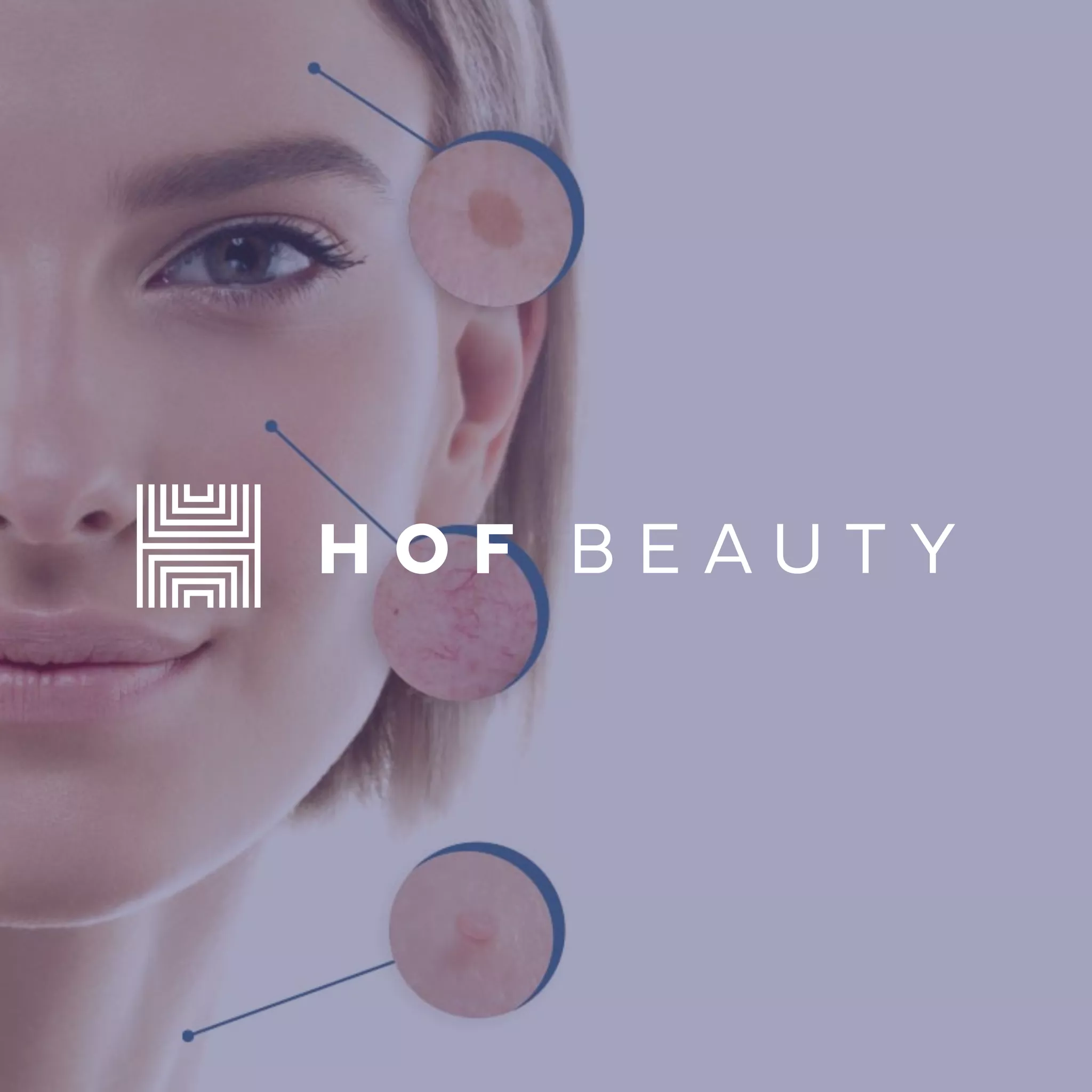 Electrocautery Thumbnail.png