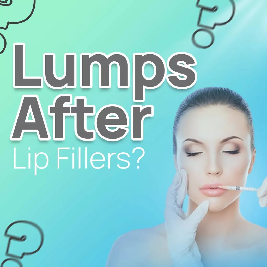 Is It Normal to Develop Lumps After Lip Fillers?