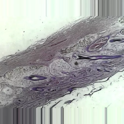 MICROSCOPE SLIDE - Human scalp V.S. hair insertion