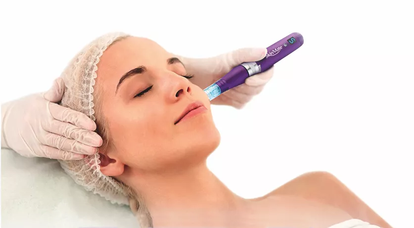 Skinmate Pen Treatment.png
