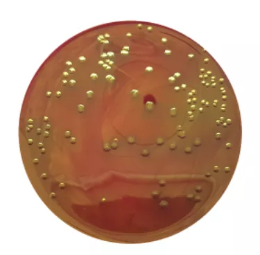 M-Endo Agar