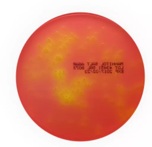 1651653995ac01ced5381703db1519533425fd7153.PNG?