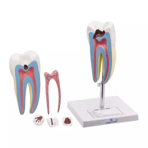 TOOTH MODEL 15 TIMES