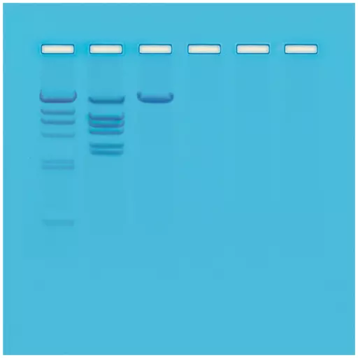 Biotechnology Restriction Enzyme Analysis of DNA