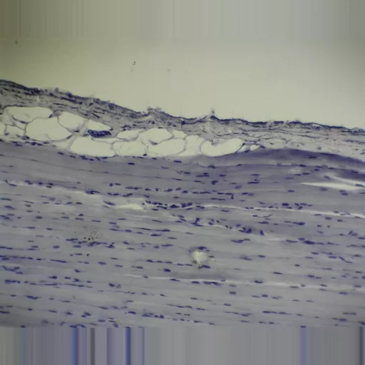 Prepared Microscope Slide - Striated Muscle: Skeletal