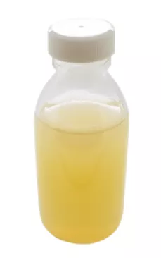 Plate Count Agar (PCA), Winchester