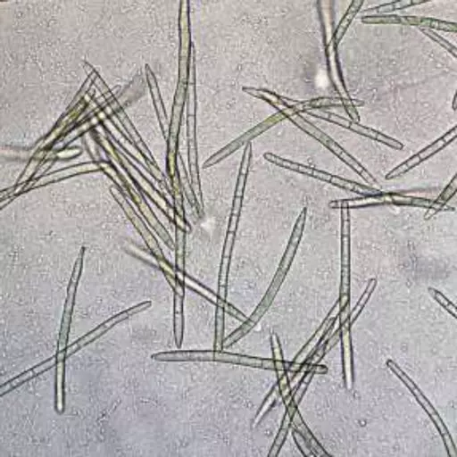 spicules blog image.png