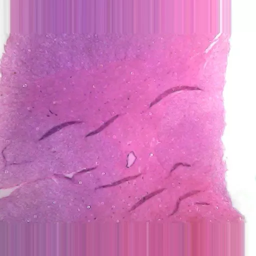 MICROSCOPE SLIDE - Peripheral nerve T.S. for general