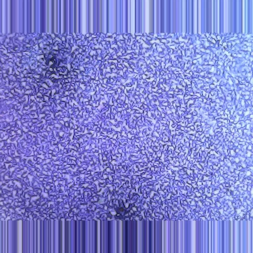 MICROSCOPE SLIDE - Human blood smear