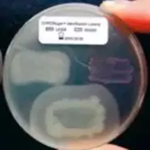 177020914911016d69e7f0d3ec5d4a914b3e5a4f77.png?