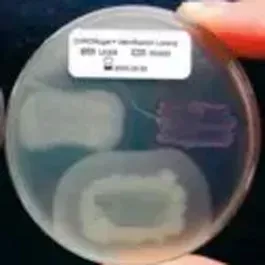 Chromogenic Dehydrated Medium for Detection of Shiga Toxin-Producing E. coli (STEC) 5L