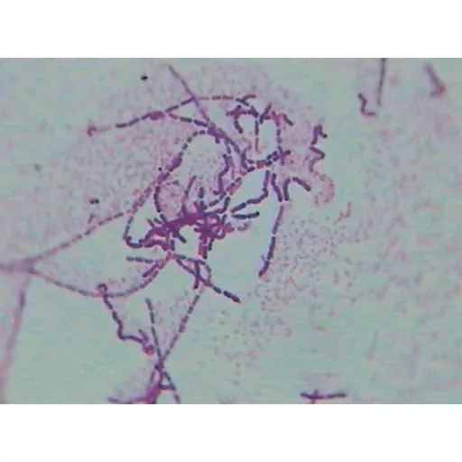 Philip Harris Prepared Microscope Slide Set - Prokaryotes - Set of 10 Slides