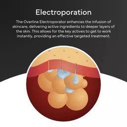 Electroporation info.png