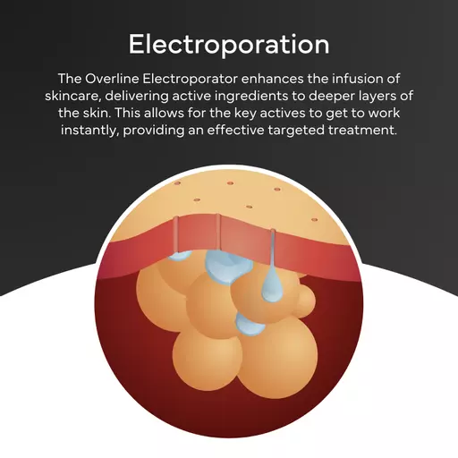 Electroporation info.png