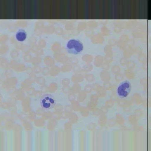 Philip Harris Prepared Microscope Slide - Lung - Injected (Thick Section)