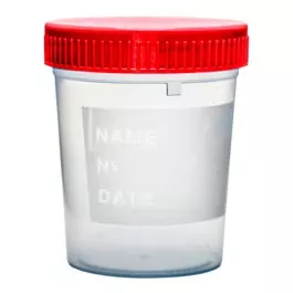 150ML Container Sterile Grad Red Cap