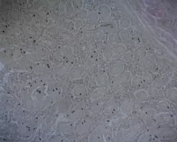 FINHC1006540.png