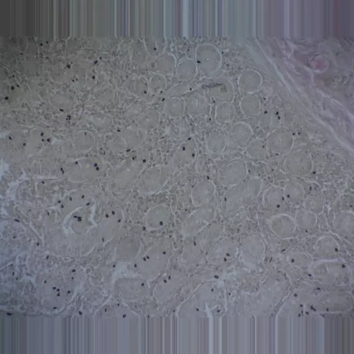 Philip Harris Prepared Microscope Slide - Non-striated (Smooth) Muscle - Intestinal Wall