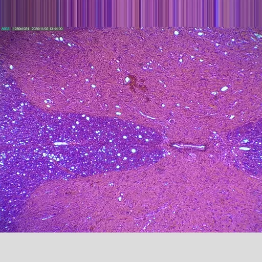 Philip Harris Prepared Microscope Slide - Spinal Cord T.S.